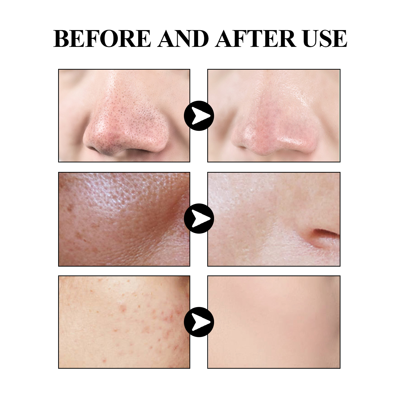 40g Activated carbon facial ma - огляд і ціна Mud Mask Kaolin