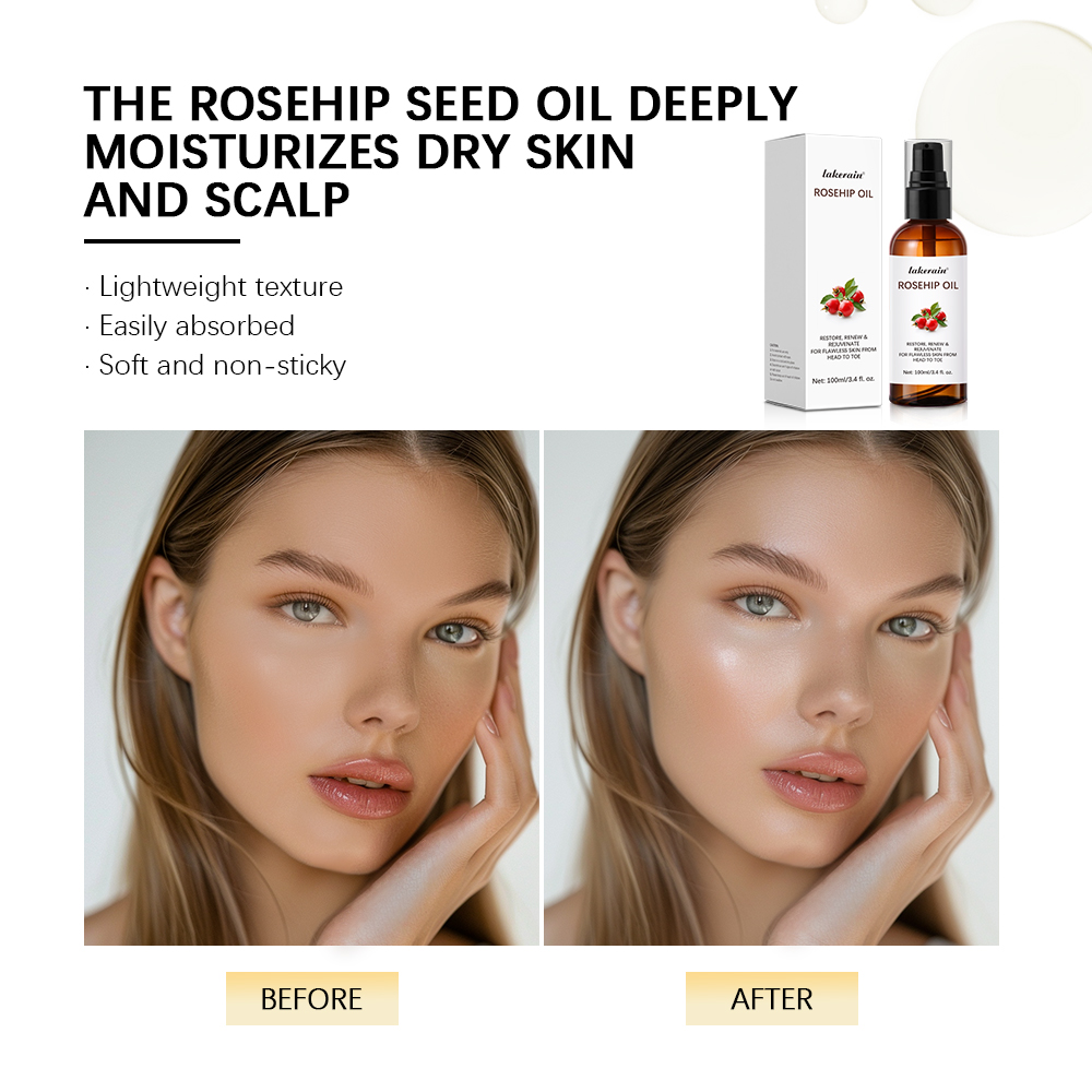 100ml Multifunction Moisturize - огляд і ціна Face Oil Rosehip