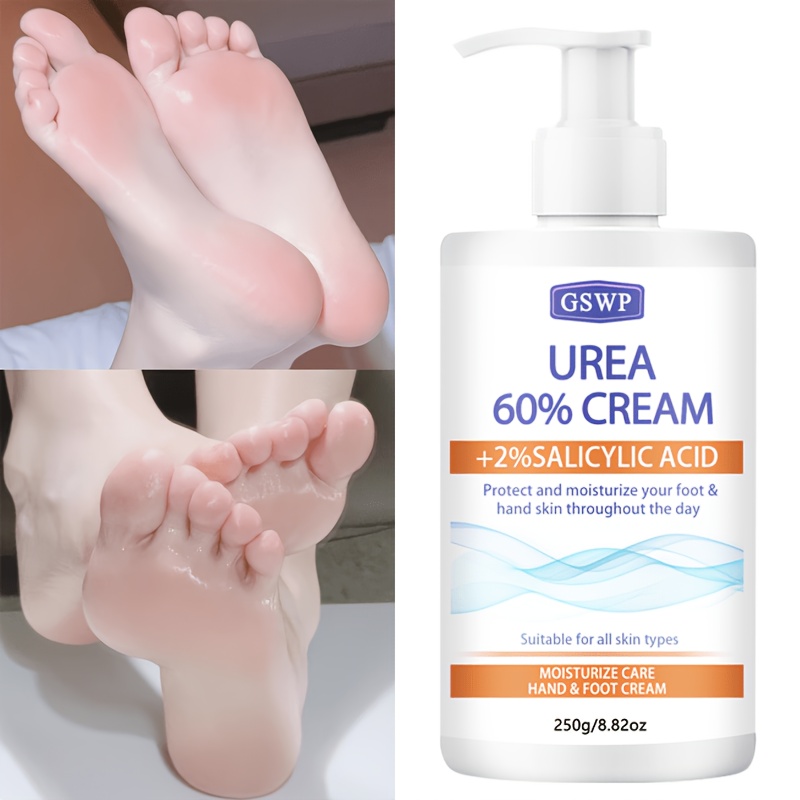 GSWP 60% Urea Moisturising Han - огляд і ціна Azelaic Acid Cream
