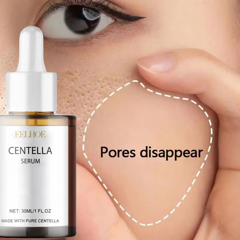 Centella Asiatica Face Serum N - огляд і ціна Azelaic Acid Cream