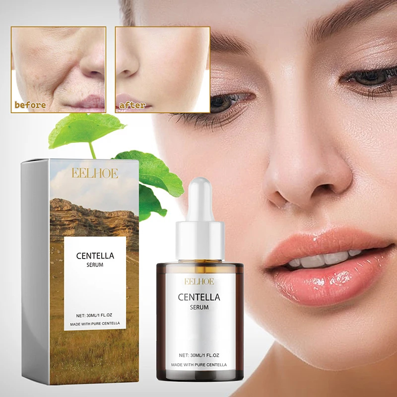 Centella Asiatica Face Serum N - огляд і ціна Azelaic Acid Cream